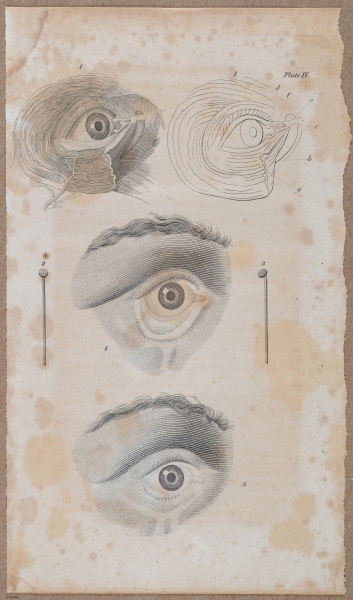 E696 - First Line of Surgery - i10014