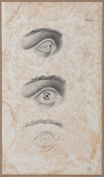 E696 - First Line of Surgery - i10016