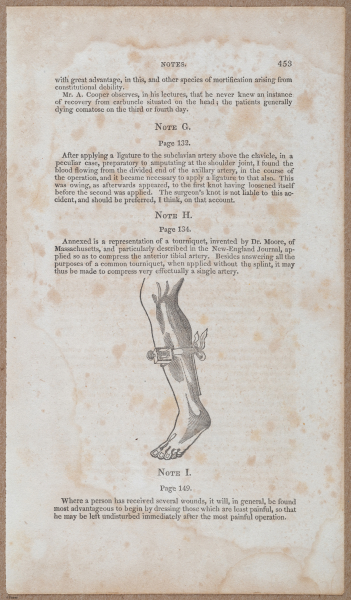 E696 - First Line of Surgery - i10018