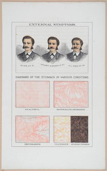 Diagrams of a Face and the Stomach